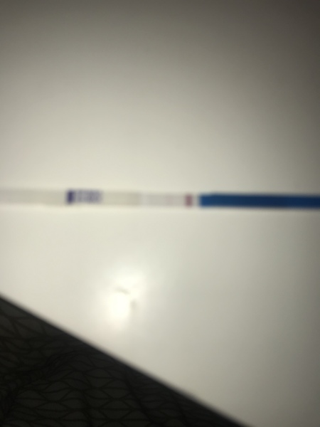 Line eyes 1 month after MC.