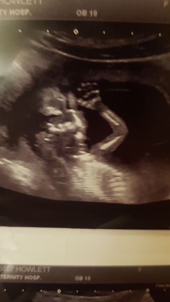 August 2019 4: All the scans and hopefully the end of nausea