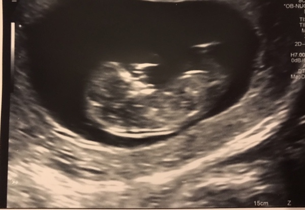 July 2019 (thread 7)