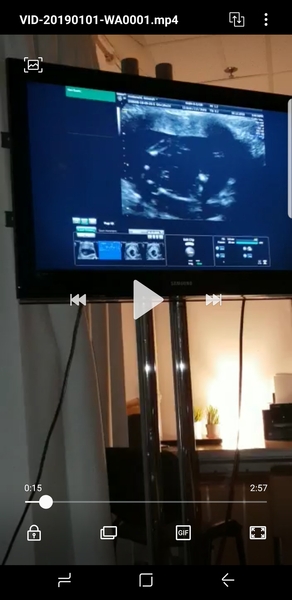 gender scan *image* guesses?