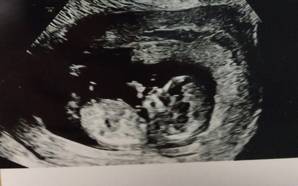 Ringing in the New Year & 2nd trimester - July 2019!