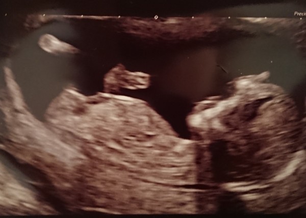 July 2019 (thread 7)