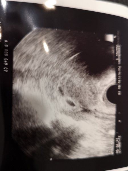 Due October 2019