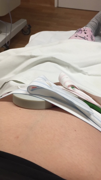 Due February 2019: here come the babies!