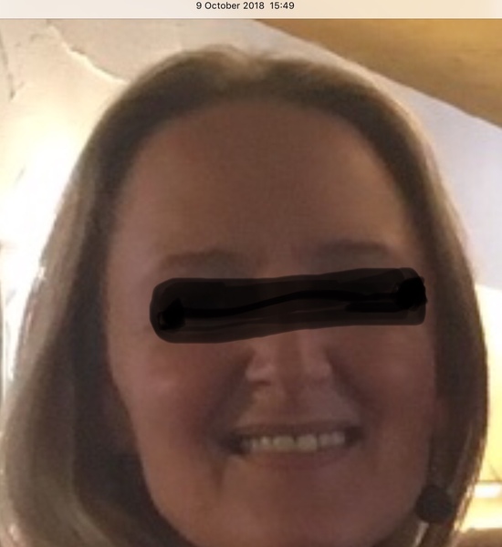 Nuface Mini - anyone have one?