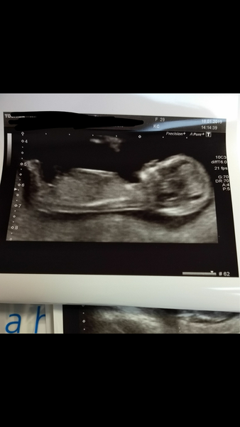 Ringing in the New Year & 2nd trimester - July 2019!