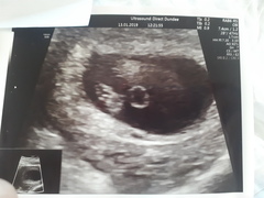 Due September 2019