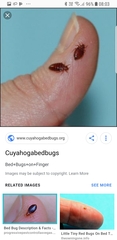 Bed bugs? Warning - Gross photos attached