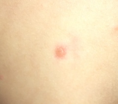 What are these spots?