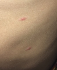What are these spots?