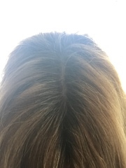 What’s the best way to cover these grey hairs? Pics attached