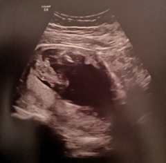 Potty shot help, confirmed both boy and girl!!