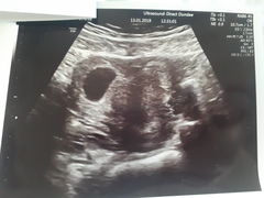 Due September 2019