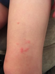Can u help identify these spots?