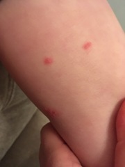 Can u help identify these spots?