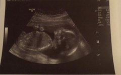 Finally time to relax and enjoy this pregnancy💙