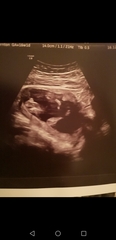 Potty shot help, confirmed both boy and girl!!