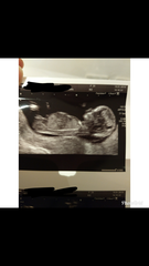 Nub theory guesses - looks different on two pics?