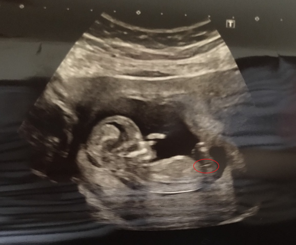 September 2019 Babies - Thread #3