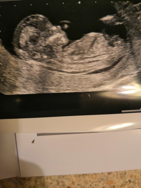 Gender guess