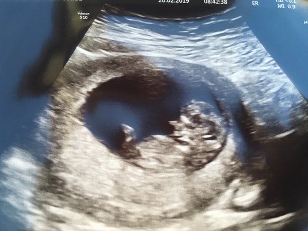 September 2019 Babies - Thread #3