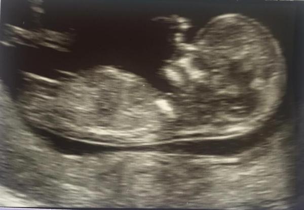 Nub theory - gender guess?