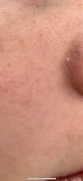 What is this? (Pic)