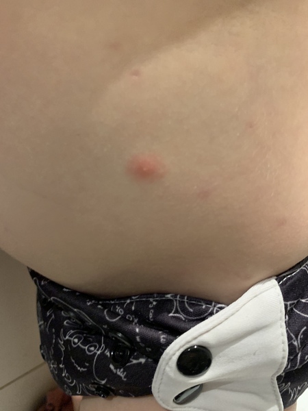 Any idea what these spots are?