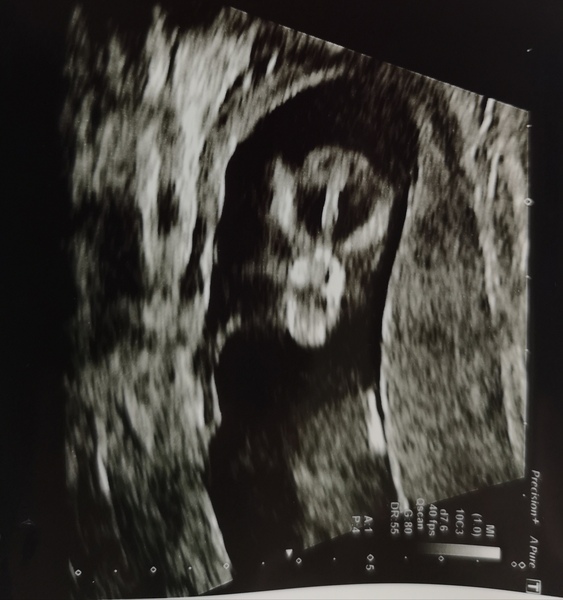 September 2019 Babies - Thread #3