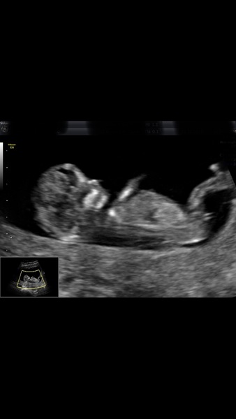 Gender guesses please you clever lot?!