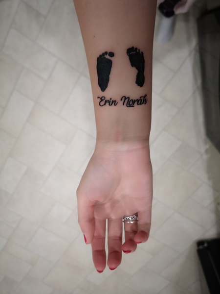 Severe ventriculomegaly diagnosed at 20 weeks