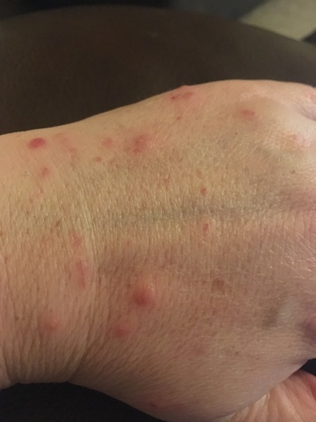 Is this infected? Pic.