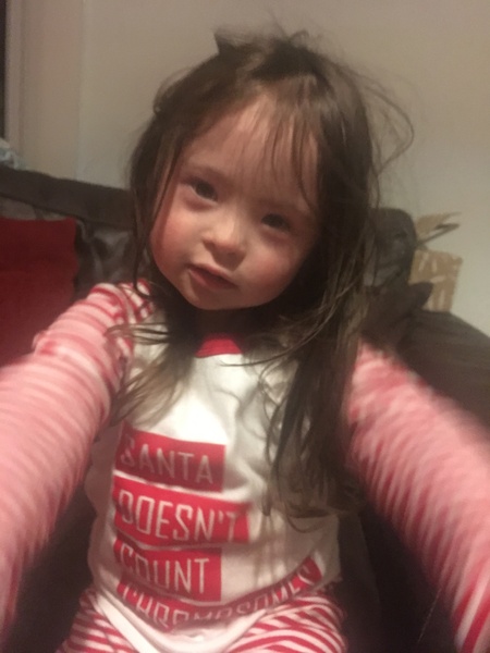 High risk of Down syndrome