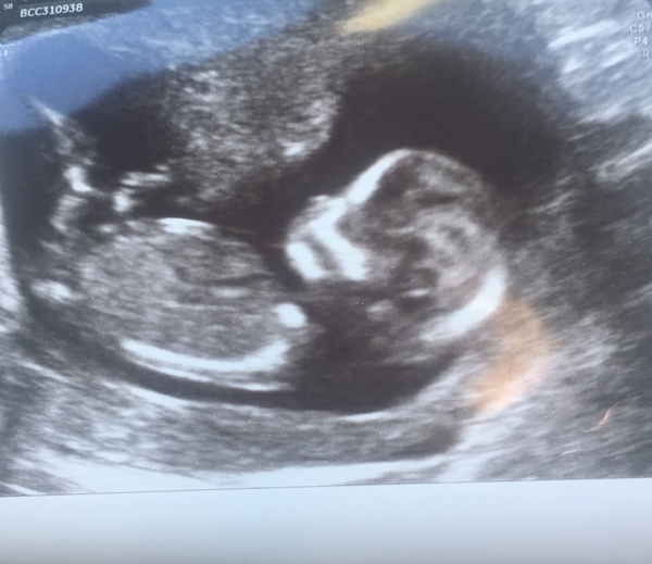 September 2019 Babies - Thread #3