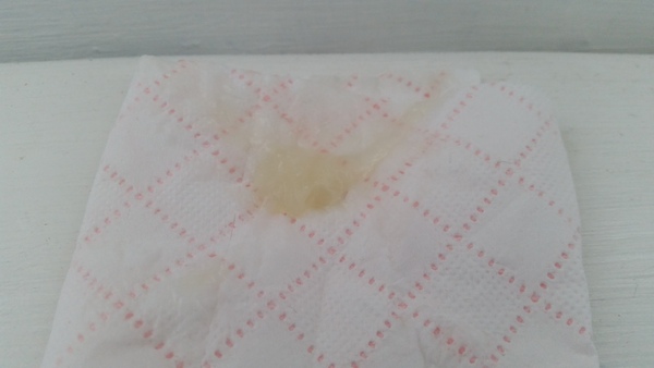 TMI mucus plug