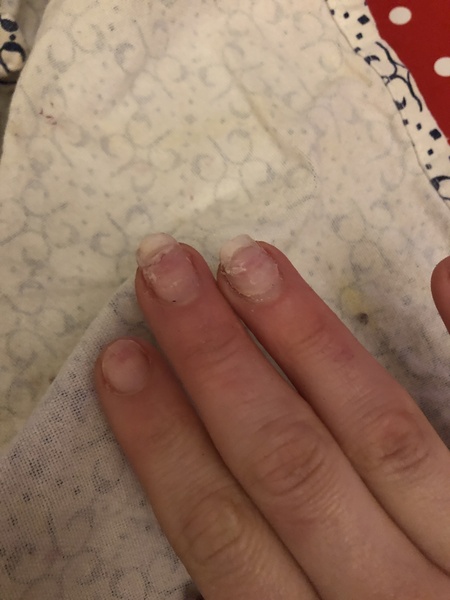 AIBU to think my nails are completely fucked now?!