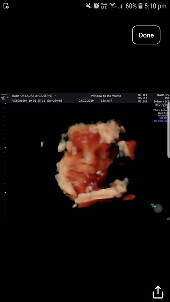 First babies due in April