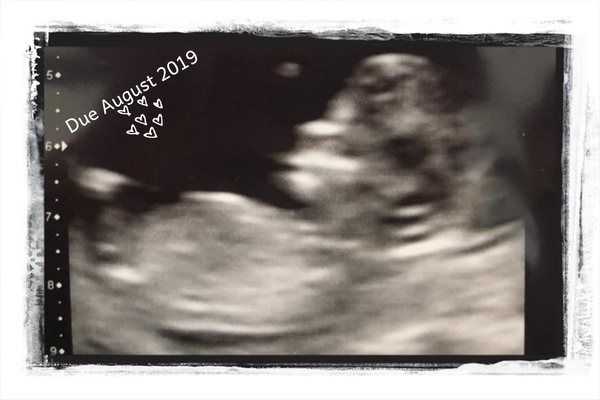 August 2019 4: All the scans and hopefully the end of nausea