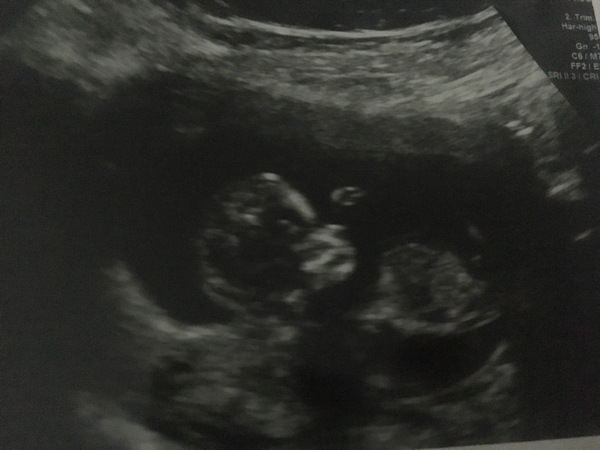 September 2019 Babies #2