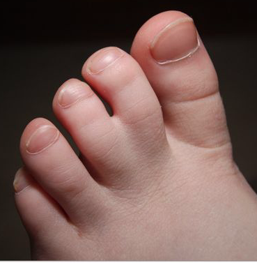 Weird toes