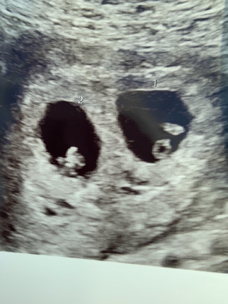 December/ January IVF&ICSI