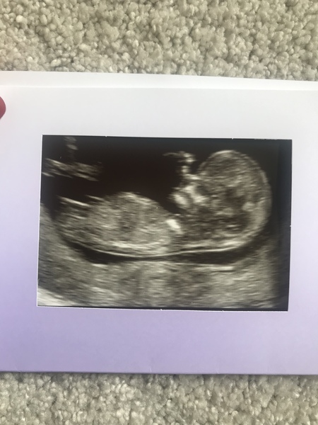 Scan pic? What gender is my baby..