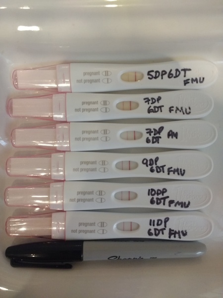 Early pregnancy after IVF & recurrent miscarriage