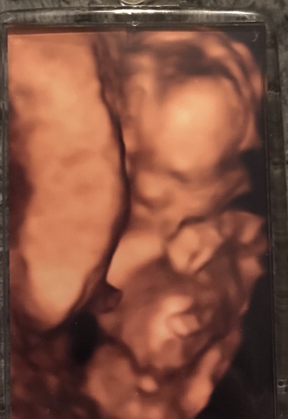 July 2019 (thread 8): pram choices, 20-week scans, and the morning gag