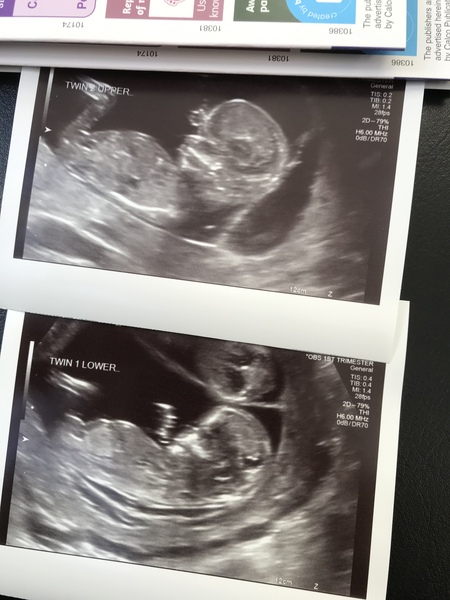 August 2019 4: All the scans and hopefully the end of nausea