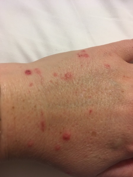 Is this infected? Pic.
