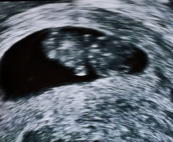 September 2019 Babies - Thread #3