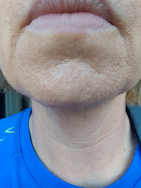 Skin Advice Please 😪