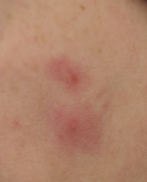 🐌 Fantastic Skincare: New Year, NuFaces