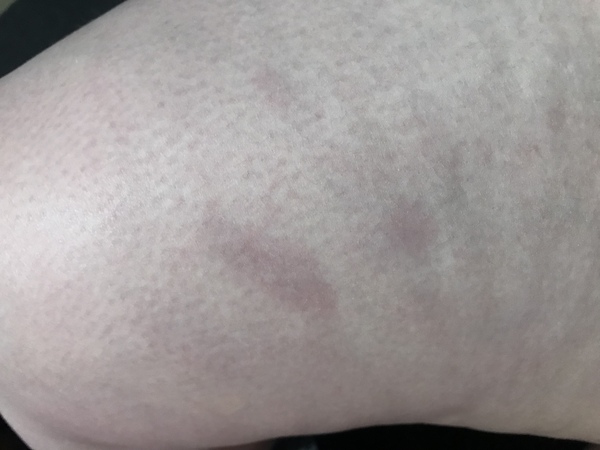 Any medical types about - not sure what’s wrong (picture)